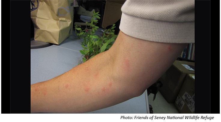 Florida Teen Tests Positive for Mosquito-Borne Keystone Virus